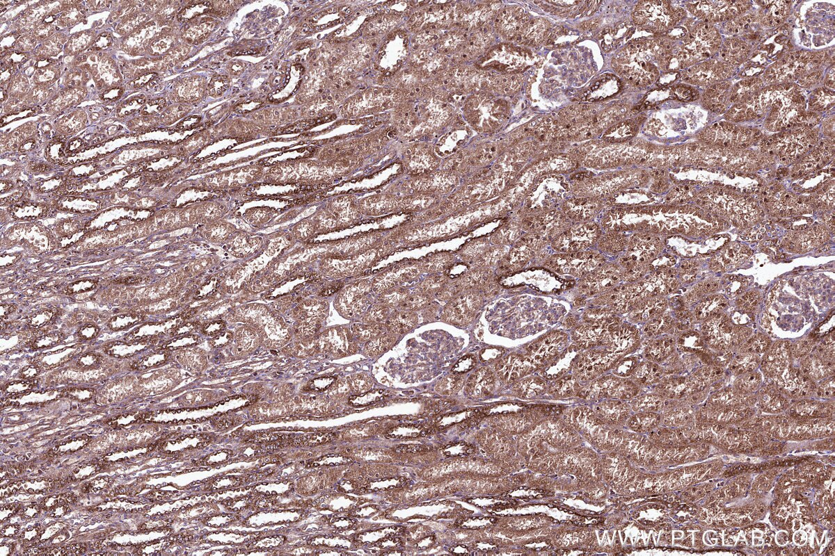 Immunohistochemical analysis of paraffin-embedded human kidney tissue slide using KHC3105 (ATPBD3 IHC Kit). Immunohistochemical analysis of paraffin-embedded human kidney tissue slide using KHC3105 (ATPBD3 IHC Kit).
