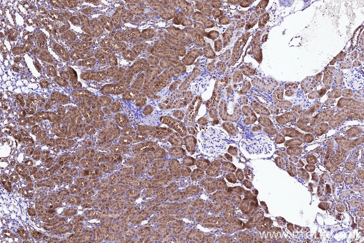 Immunohistochemical analysis of paraffin-embedded rat kidney tissue slide using KHC3105 (ATPBD3 IHC Kit). Immunohistochemical analysis of paraffin-embedded rat kidney tissue slide using KHC3105 (ATPBD3 IHC Kit).