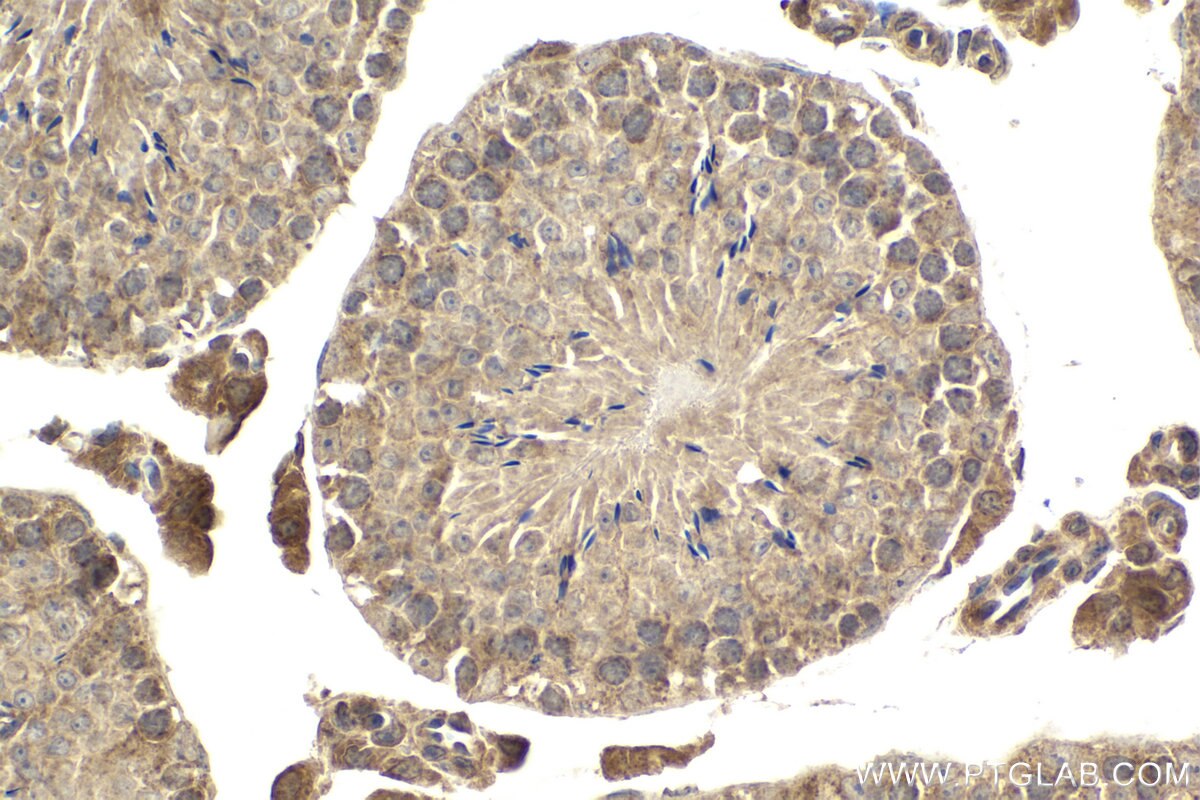 Immunohistochemical analysis of paraffin-embedded mouse testis tissue slide using KHC2064 (AURKA IHC Kit).