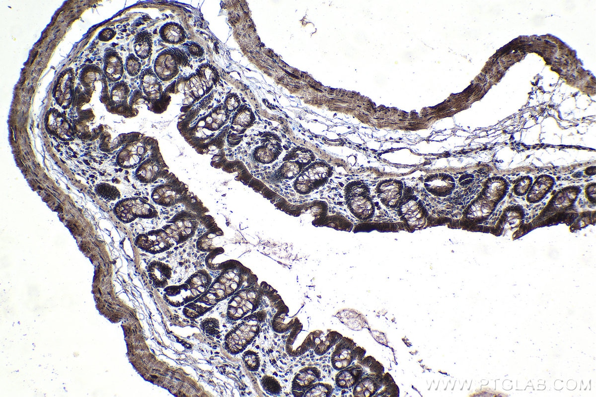 Immunohistochemical analysis of paraffin-embedded rat colon tissue slide using KHC1440 (AXIN1 IHC Kit).