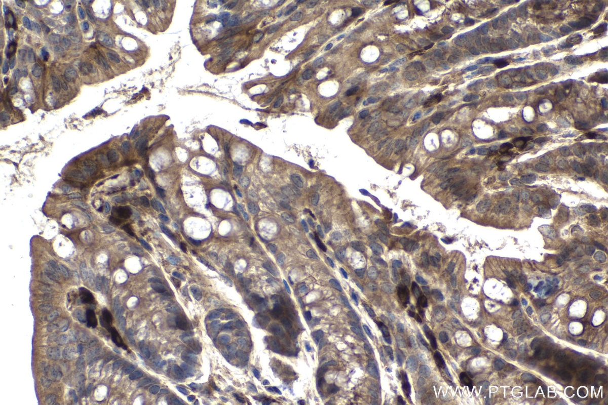 Immunohistochemical analysis of paraffin-embedded mouse colon tissue slide using KHC1440 (AXIN1 IHC Kit).