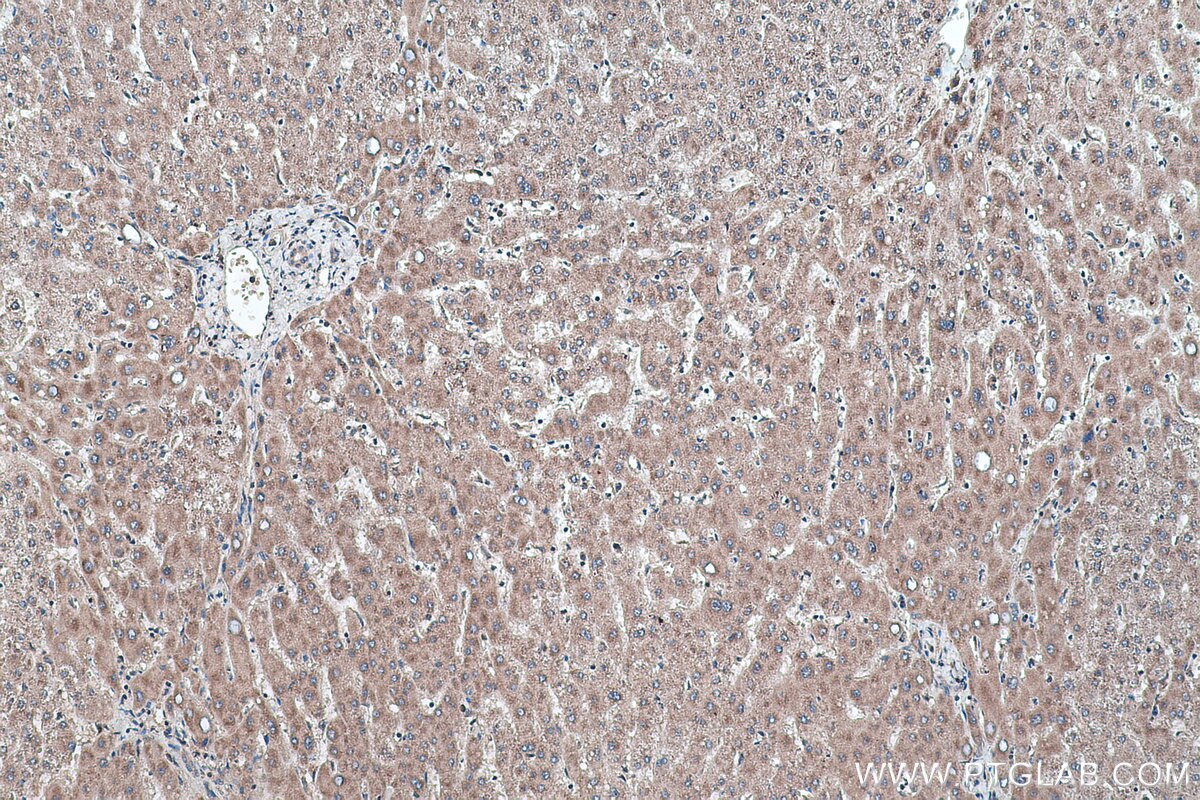 Immunohistochemical analysis of paraffin-embedded human liver tissue slide using KHC0473 (AXIN2 IHC Kit).