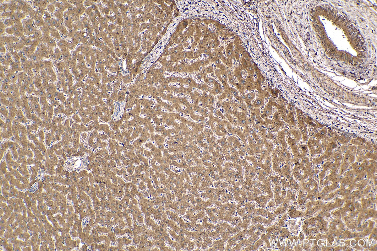 Immunohistochemical analysis of paraffin-embedded human liver tissue slide using KHC0401 (AZGP1 IHC Kit).