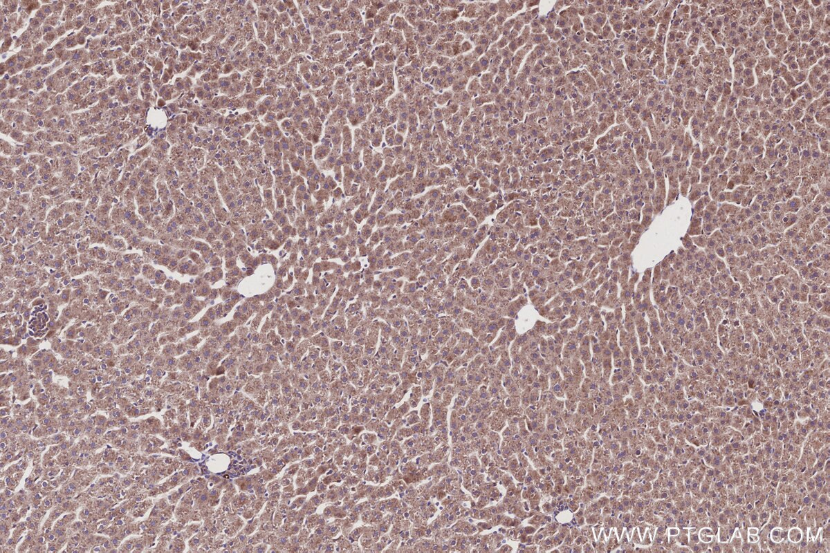 Immunohistochemical analysis of paraffin-embedded rat liver tissue slide using KHC2922 (AZI2/NAP1 IHC Kit).
