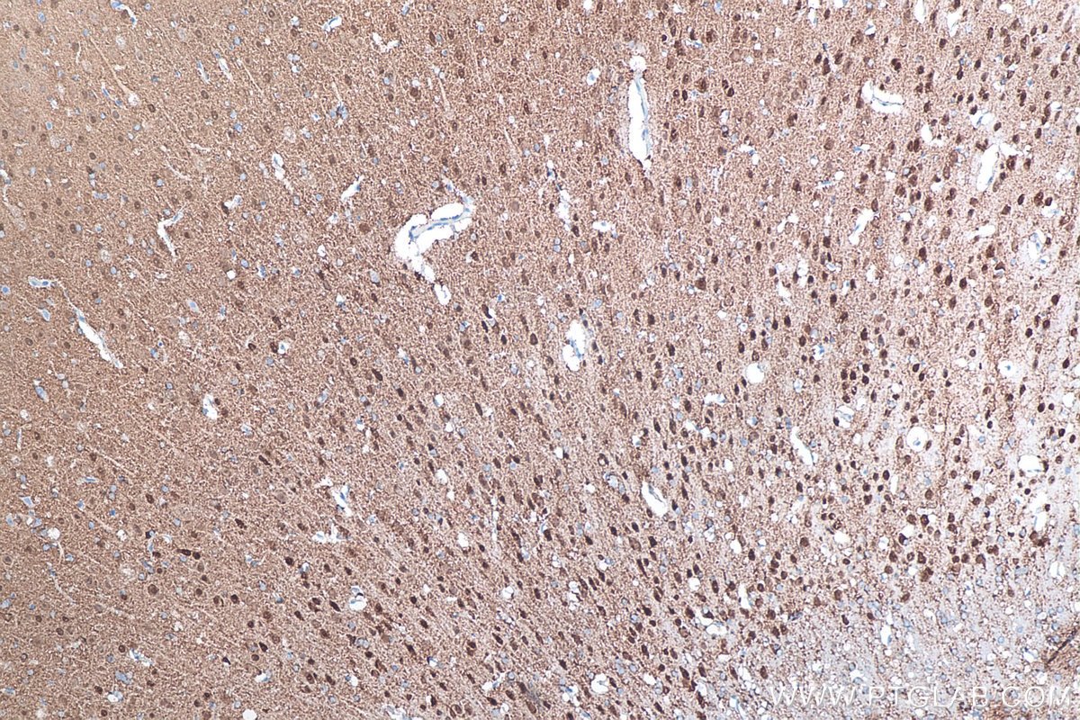 Immunohistochemical analysis of paraffin-embedded rat brain tissue slide using KHC0290 (Alpha Synuclein IHC Kit).