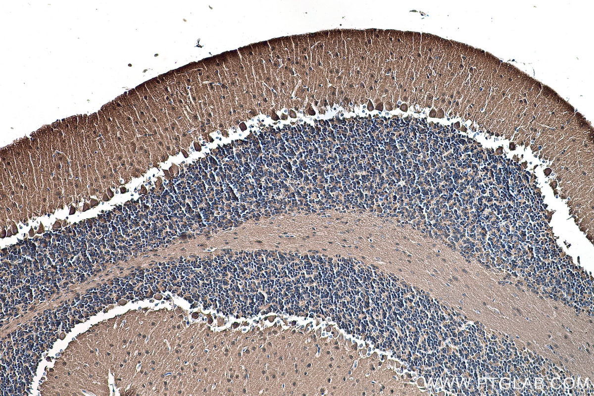 Immunohistochemical analysis of paraffin-embedded mouse cerebellum tissue slide using KHC0290 (Alpha Synuclein IHC Kit).