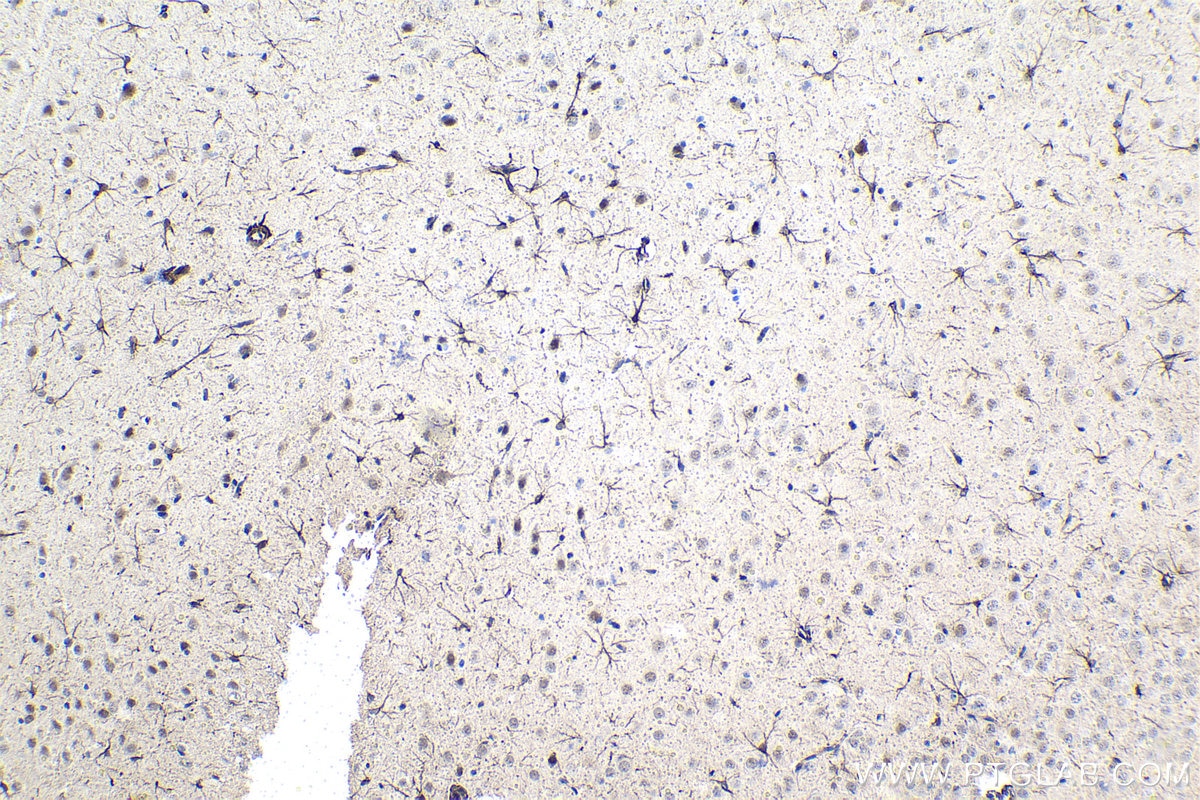 Immunohistochemical analysis of paraffin-embedded rat brain tissue slide using KHC1500 (BAG3 IHC Kit).