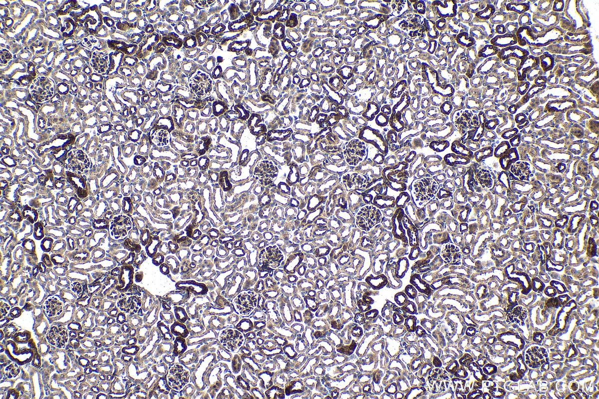Immunohistochemical analysis of paraffin-embedded mouse kidney tissue slide using KHC1500 (BAG3 IHC Kit).