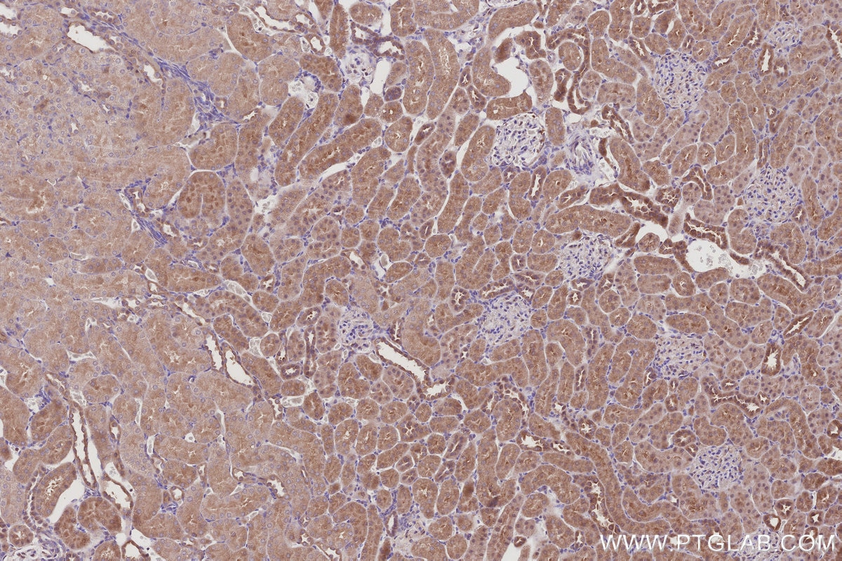 Immunohistochemical analysis of paraffin-embedded rat kidney tissue slide using KHC3010 (BAIAP2L1 IHC Kit).