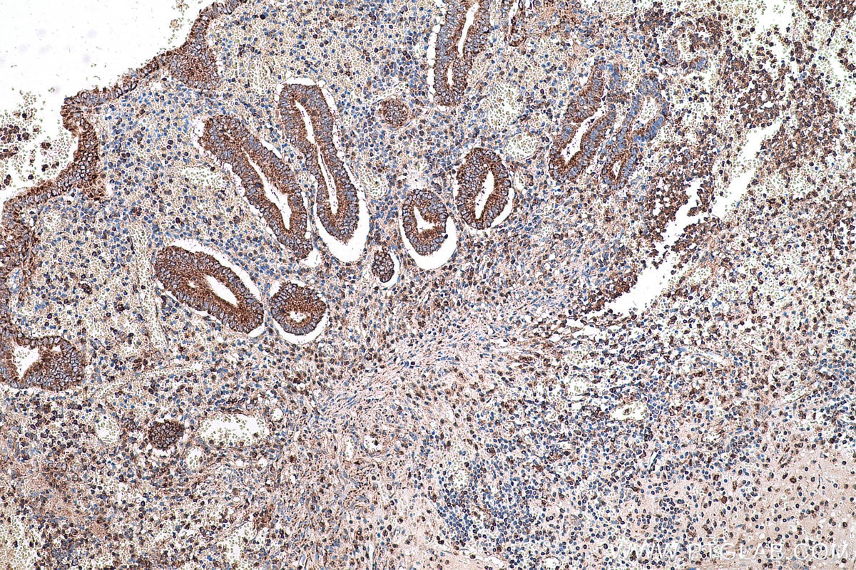 Immunohistochemical analysis of paraffin-embedded human appendicitis tissue slide using KHC0605 (BAK IHC Kit).