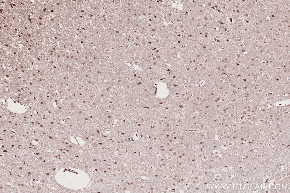 Immunohistochemical analysis of paraffin-embedded mouse brain tissue slide using KHC2693 (BANP IHC Kit).