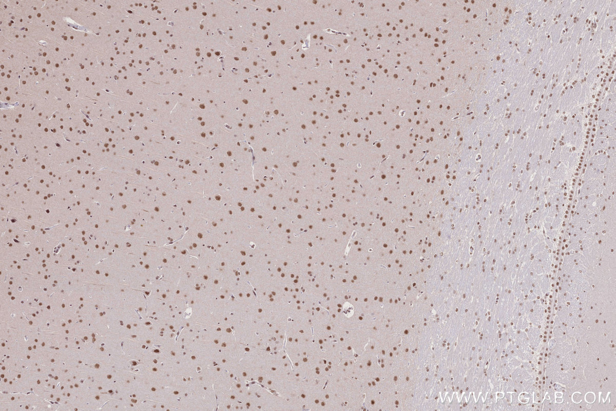 Immunohistochemical analysis of paraffin-embedded rat brain tissue slide using KHC2693 (BANP IHC Kit).