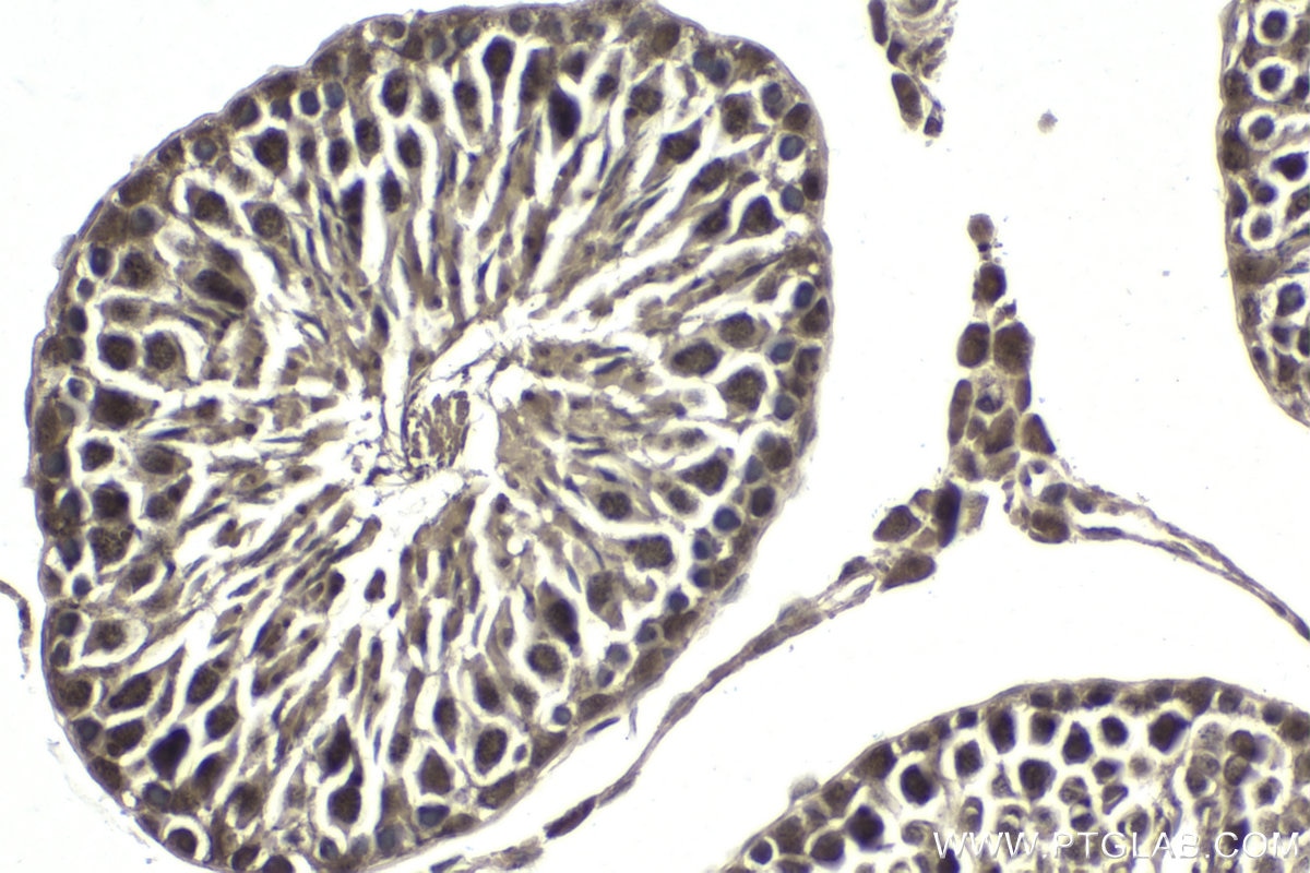 Immunohistochemical analysis of paraffin-embedded rat testis tissue slide using KHC1759 (BATF IHC Kit).