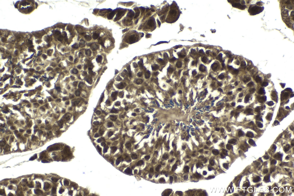 Immunohistochemical analysis of paraffin-embedded mouse testis tissue slide using KHC1759 (BATF IHC Kit).
