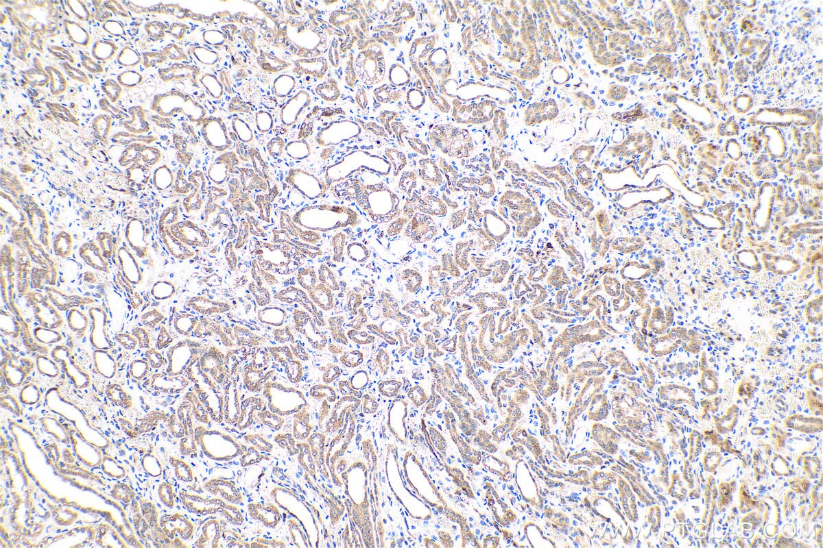 Immunohistochemical analysis of paraffin-embedded human kidney tissue slide using KHC0768 (BAX IHC Kit).