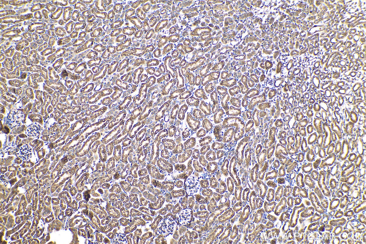 Immunohistochemical analysis of paraffin-embedded mouse kidney tissue slide using KHC0768 (BAX IHC Kit).