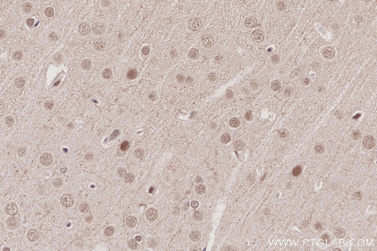 Immunohistochemical analysis of paraffin-embedded rat brain tissue slide using KHC3013 (BAZ1B/WSTF IHC Kit).