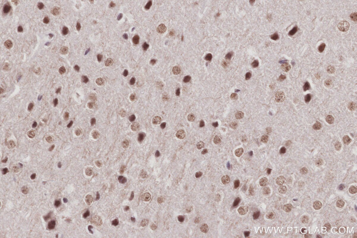 Immunohistochemical analysis of paraffin-embedded mouse brain tissue slide using KHC3013 (BAZ1B/WSTF IHC Kit).