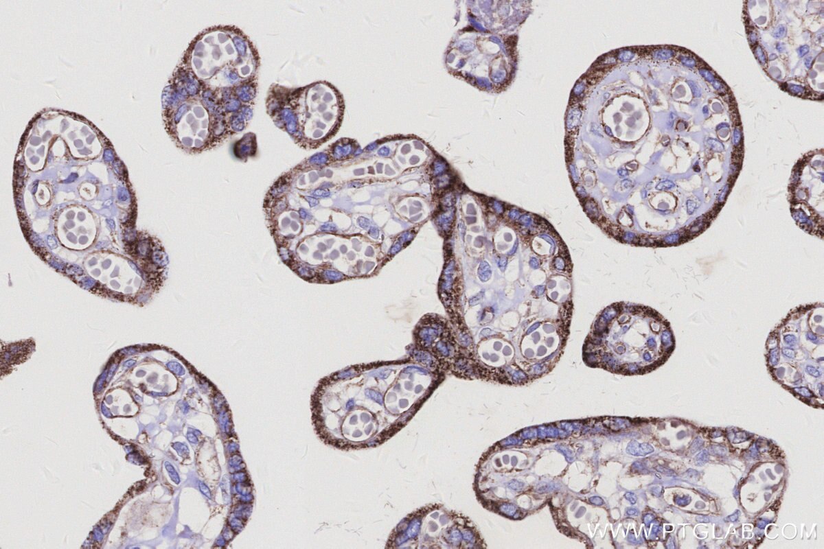 Immunohistochemical analysis of paraffin-embedded human placenta tissue slide using KHC3140 (BCAT2 IHC Kit). Immunohistochemical analysis of paraffin-embedded human placenta tissue slide using KHC3140 (BCAT2 IHC Kit).