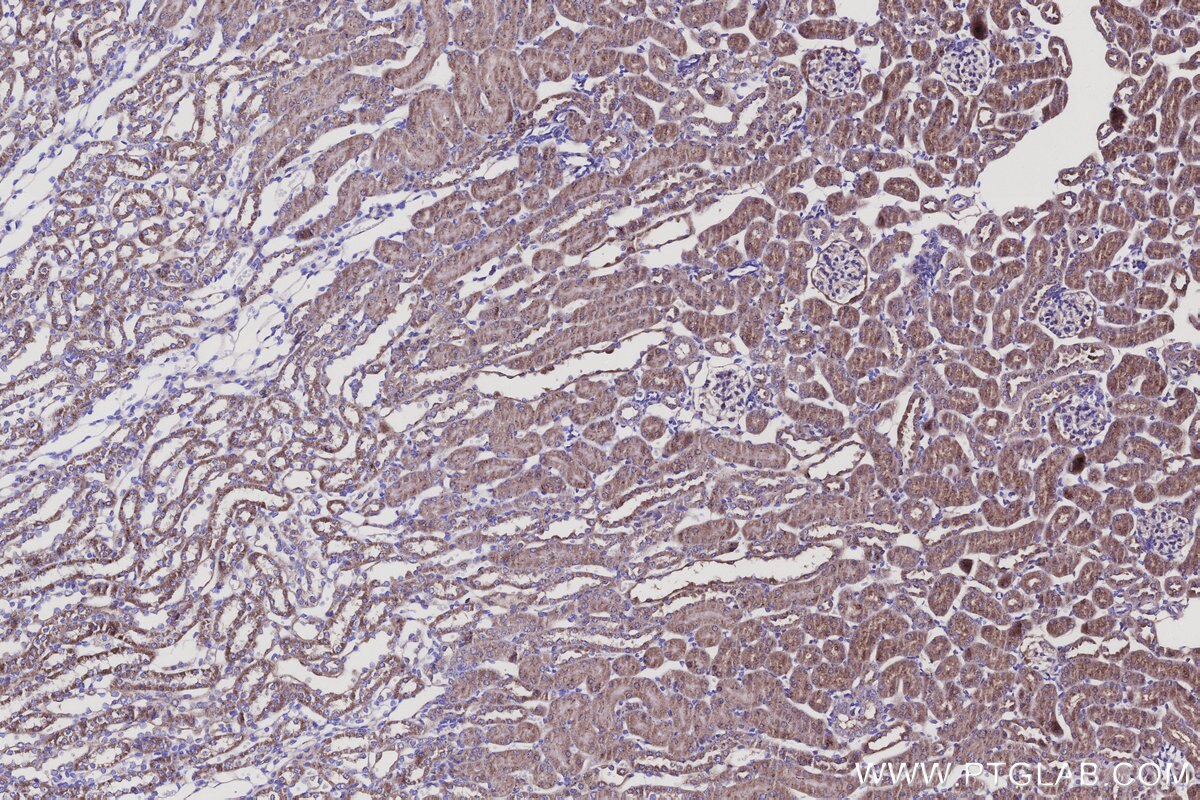 Immunohistochemical analysis of paraffin-embedded mouse kidney tissue slide using KHC3140 (BCAT2 IHC Kit). Immunohistochemical analysis of paraffin-embedded mouse kidney tissue slide using KHC3140 (BCAT2 IHC Kit).