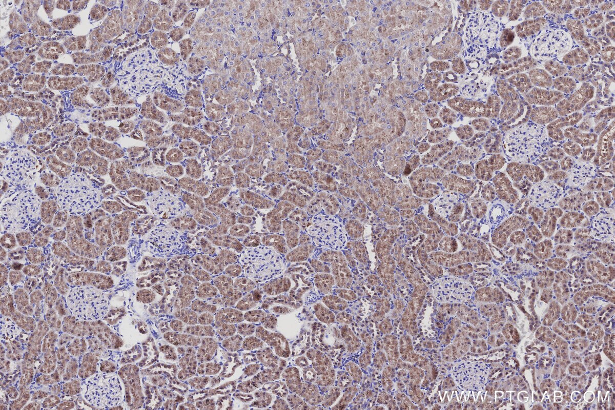 Immunohistochemical analysis of paraffin-embedded rat kidney tissue slide using KHC3140 (BCAT2 IHC Kit). Immunohistochemical analysis of paraffin-embedded rat kidney tissue slide using KHC3140 (BCAT2 IHC Kit).