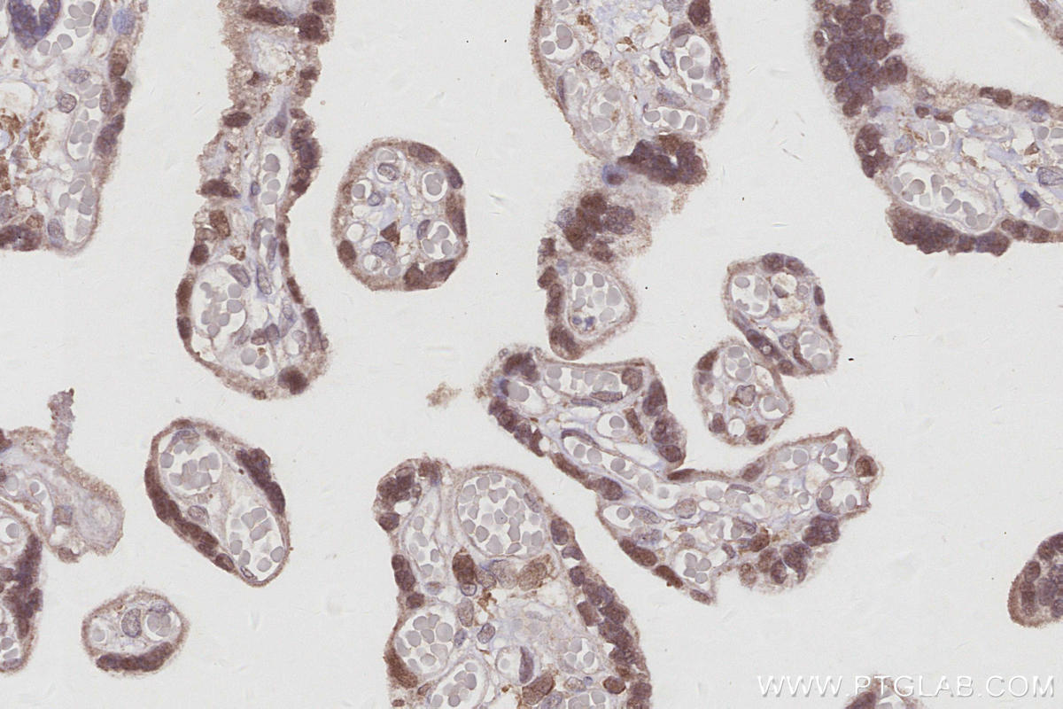 Immunohistochemical analysis of paraffin-embedded human placenta tissue slide using KHC2990 (BCCIP IHC Kit).