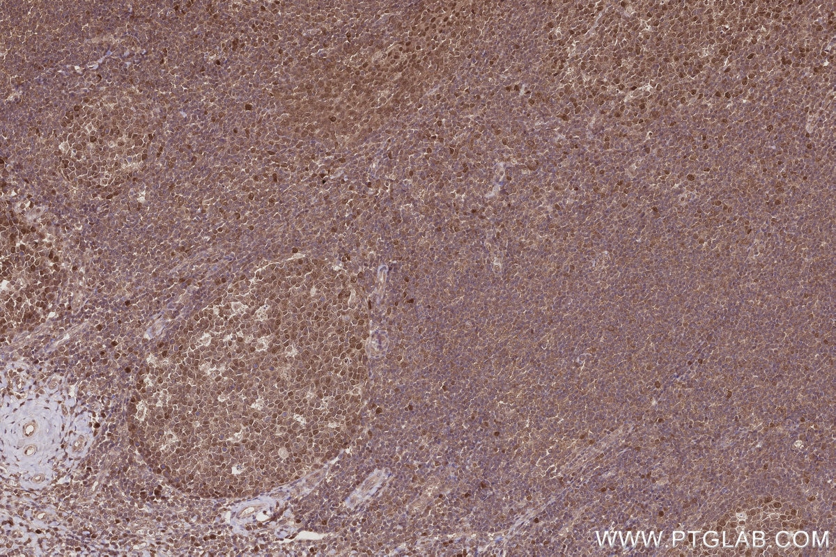 Immunohistochemical analysis of paraffin-embedded human tonsillitis tissue slide using KHC2990 (BCCIP IHC Kit).