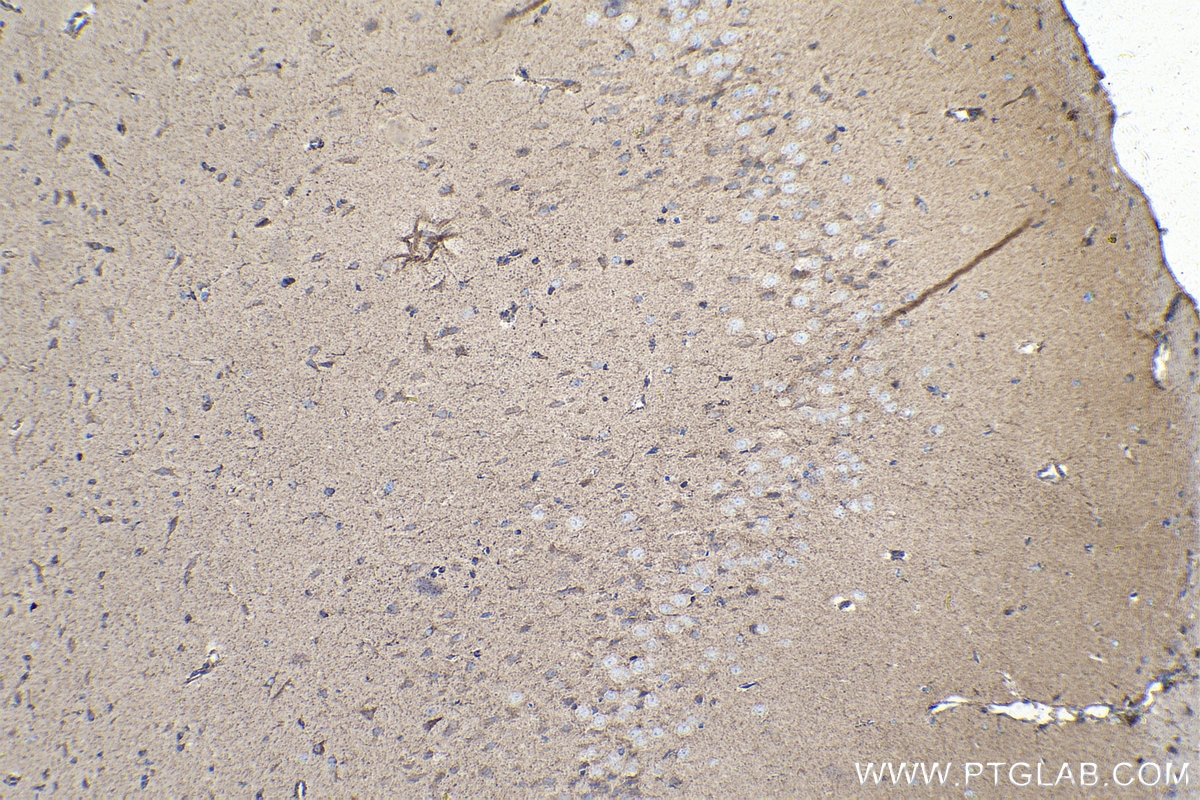 Immunohistochemical analysis of paraffin-embedded rat brain tissue slide using KHC1411 (BCKDHA IHC Kit).