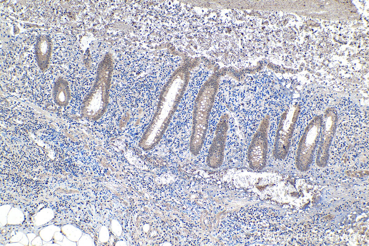 Immunohistochemical analysis of paraffin-embedded human appendicitis tissue slide using KHC1502 (BCL10 IHC Kit).