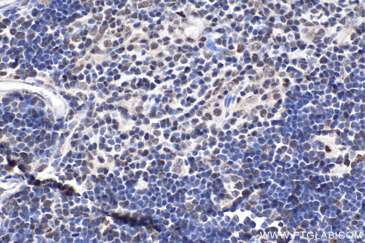 Immunohistochemical analysis of paraffin-embedded mouse thymus tissue slide using KHC1923 (BCL11A IHC Kit).