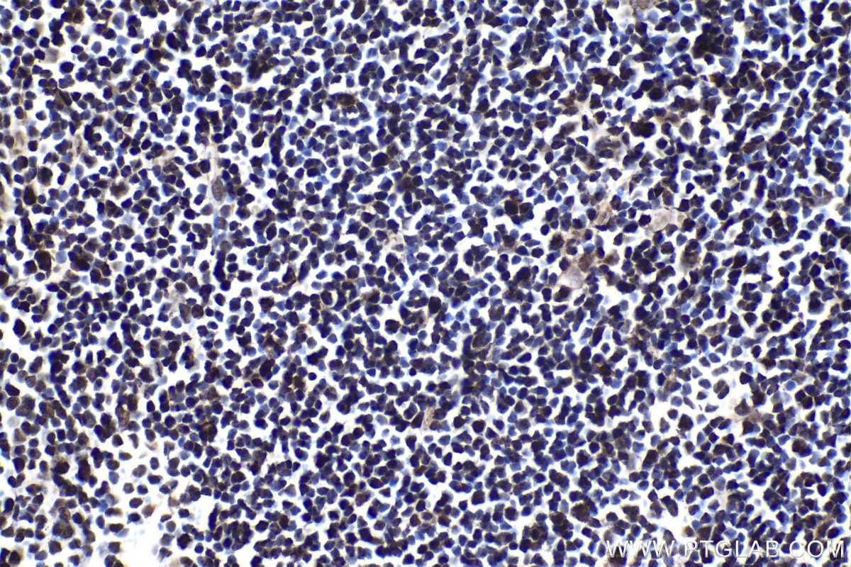 Immunohistochemical analysis of paraffin-embedded rat thymus tissue slide using KHC1923 (BCL11A IHC Kit).