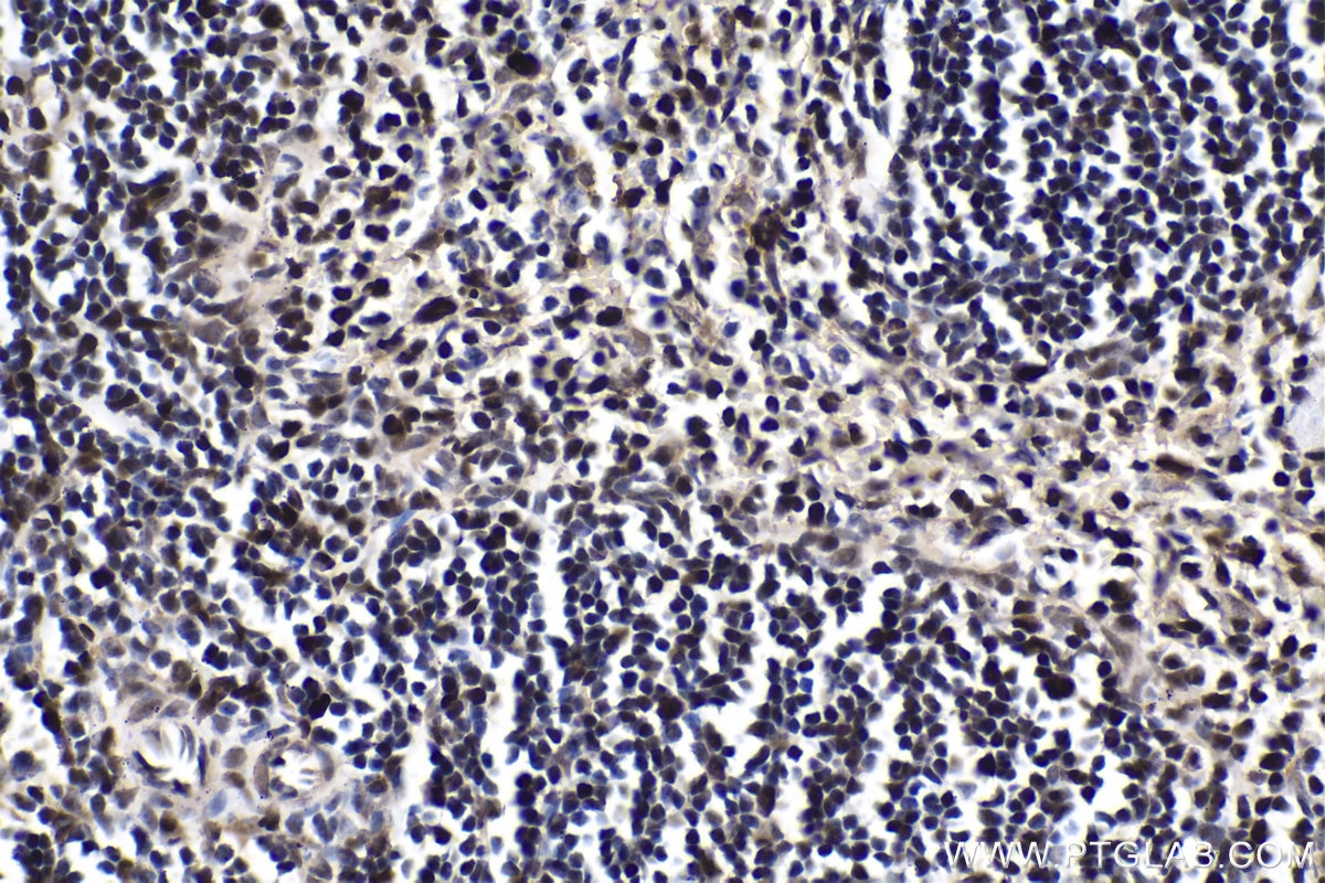 Immunohistochemical analysis of paraffin-embedded mouse spleen tissue slide using KHC1923 (BCL11A IHC Kit).