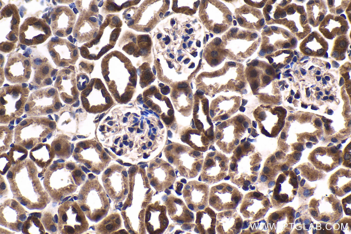 Immunohistochemical analysis of paraffin-embedded mouse kidney tissue slide using KHC1684 (BCL2L1 IHC Kit).