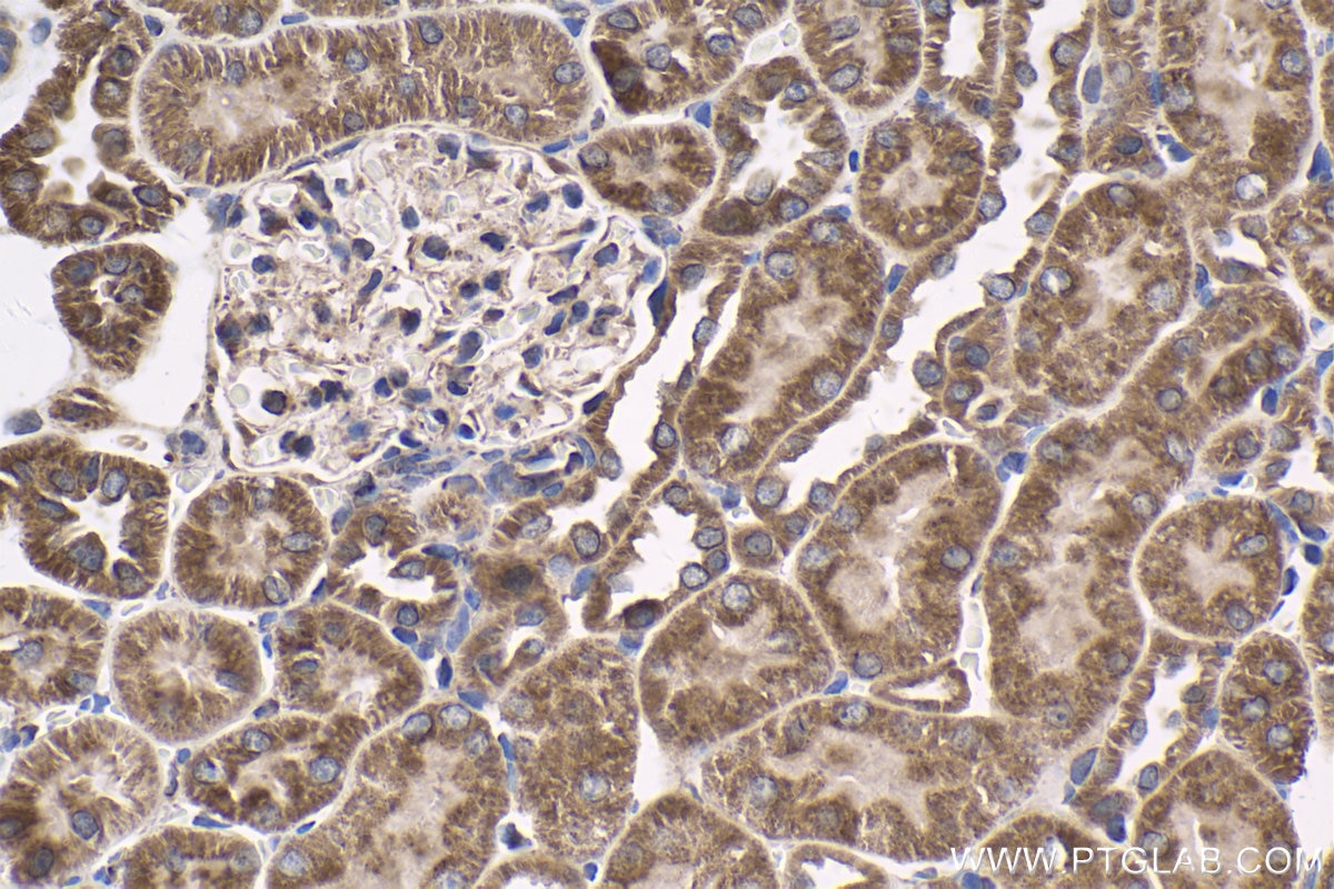 Immunohistochemical analysis of paraffin-embedded rat kidney tissue slide using KHC1684 (BCL2L1 IHC Kit).