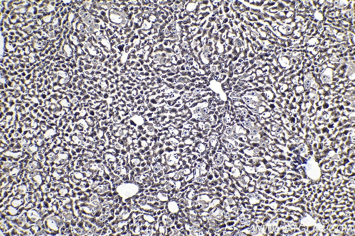 Immunohistochemical analysis of paraffin-embedded mouse liver tissue slide using KHC1413 (BCL2L2 IHC Kit).