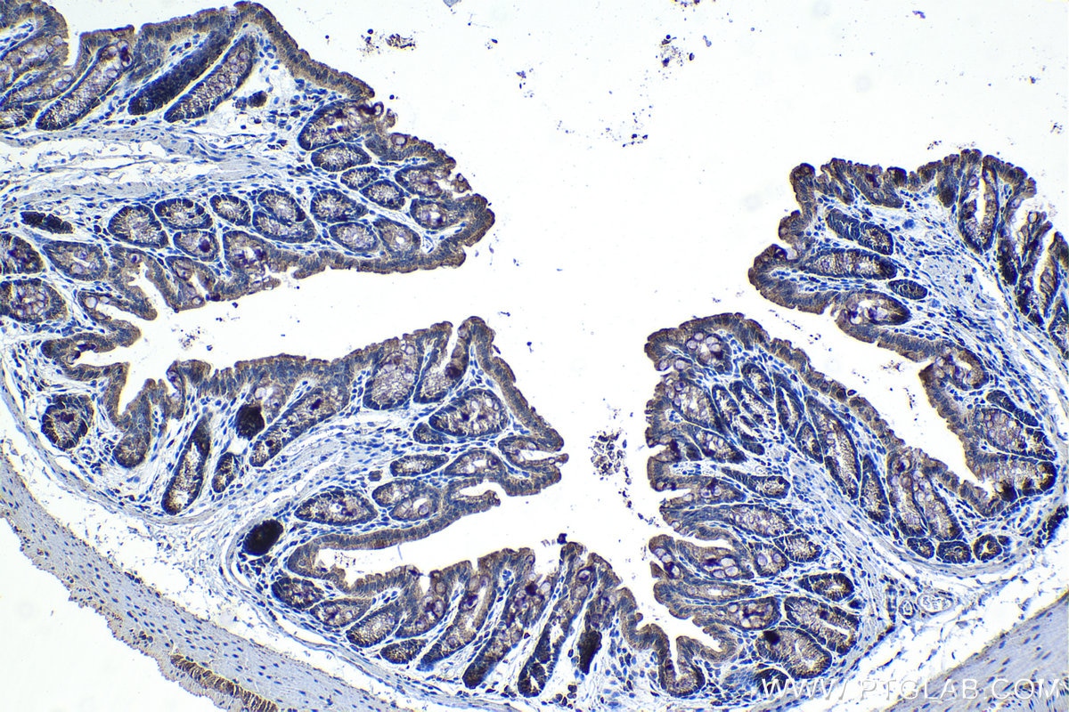 Immunohistochemical analysis of paraffin-embedded mouse colon tissue slide using KHC1356 (BDH1 IHC Kit).