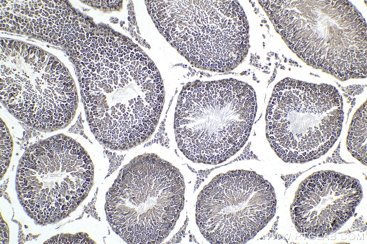 Immunohistochemical analysis of paraffin-embedded rat testis tissue slide using KHC1731 (BECN1 IHC Kit).