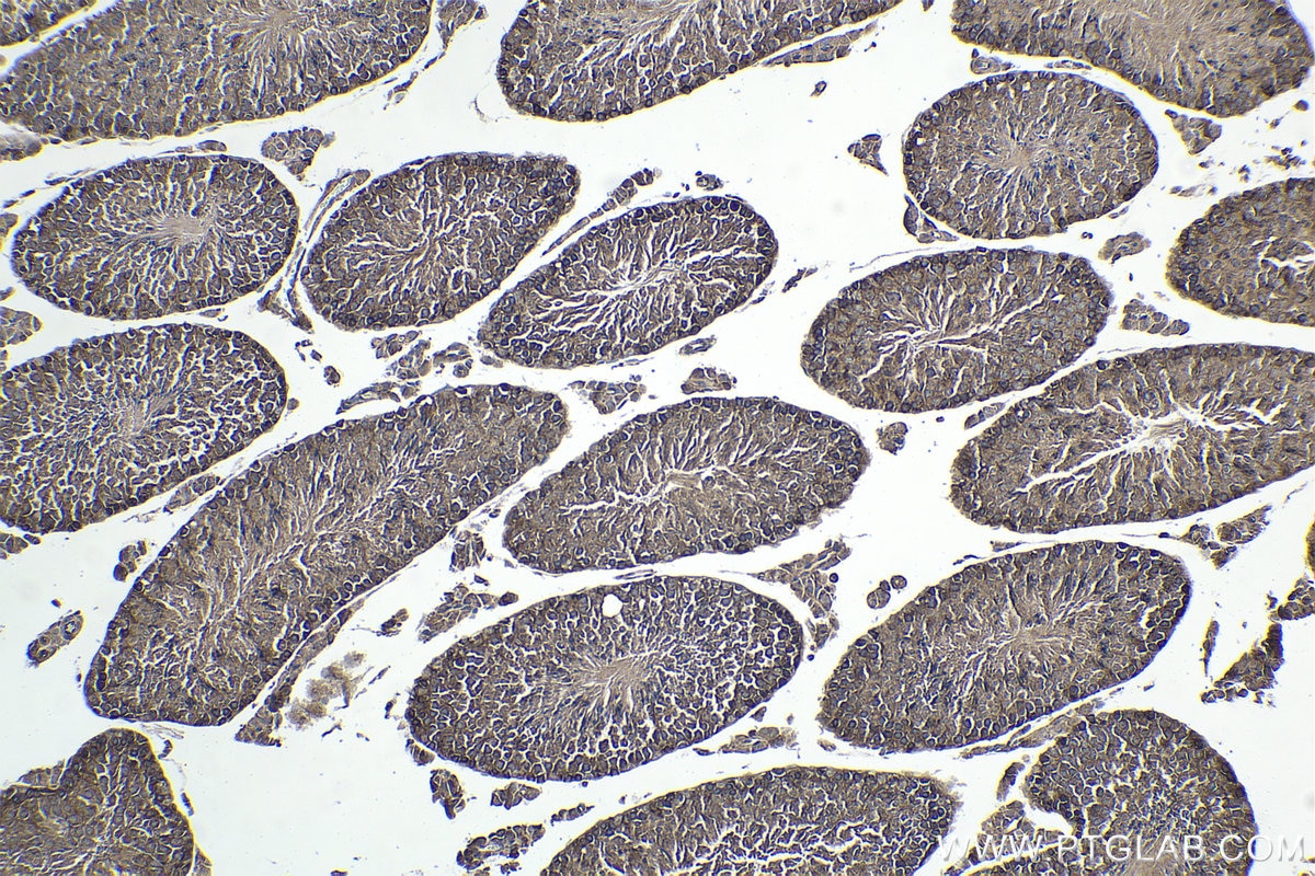 Immunohistochemical analysis of paraffin-embedded mouse testis tissue slide using KHC1731 (BECN1 IHC Kit).