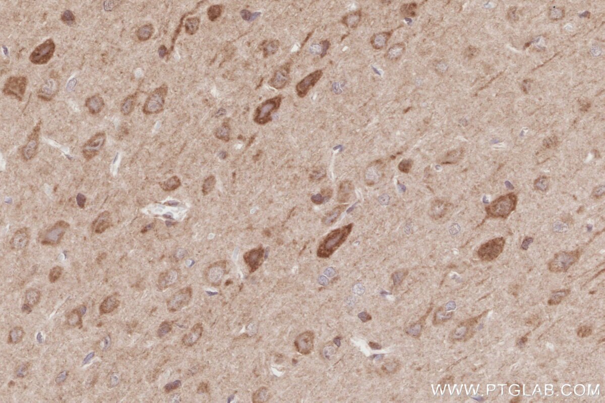 Immunohistochemical analysis of paraffin-embedded rat brain tissue slide using KHC2884 (BEX1/2 IHC Kit). Immunohistochemical analysis of paraffin-embedded rat brain tissue slide using KHC2884 (BEX1/2 IHC Kit).