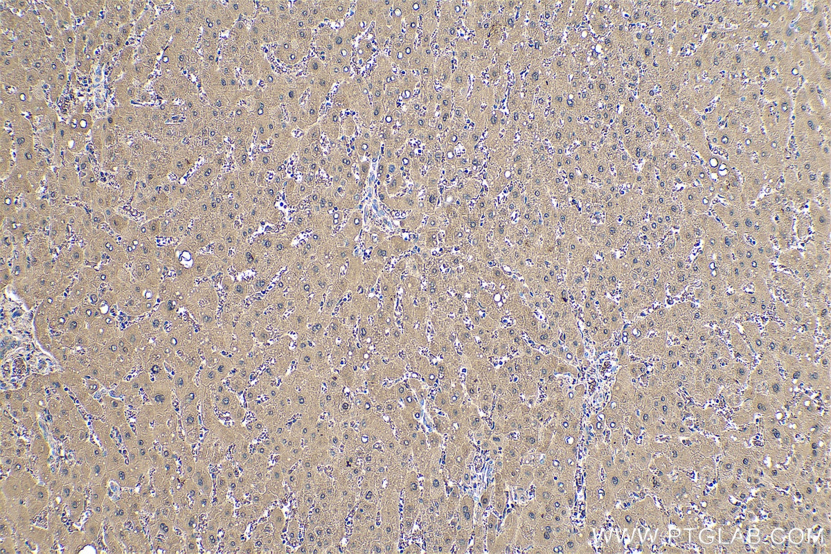 Immunohistochemical analysis of paraffin-embedded human liver tissue slide using KHC0515 (BHMT IHC Kit).