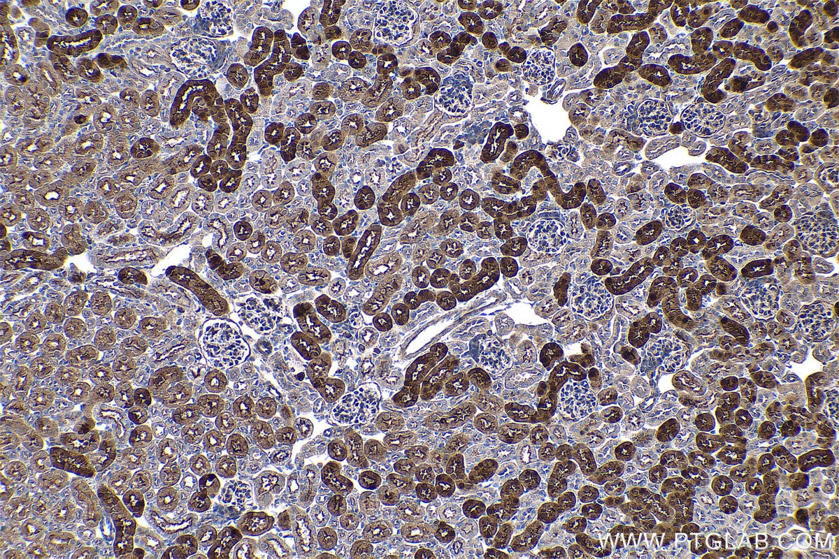 Immunohistochemical analysis of paraffin-embedded mouse kidney tissue slide using KHC0515 (BHMT IHC Kit).