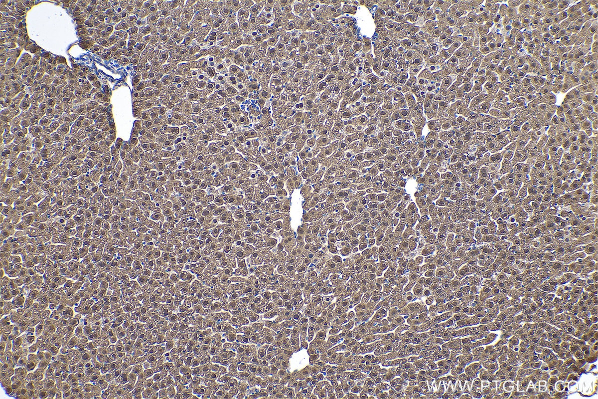 Immunohistochemical analysis of paraffin-embedded mouse liver tissue slide using KHC0515 (BHMT IHC Kit).