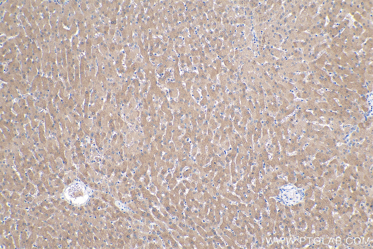 Immunohistochemical analysis of paraffin-embedded human liver tissue slide using KHC0402 (BHMT2 IHC Kit).