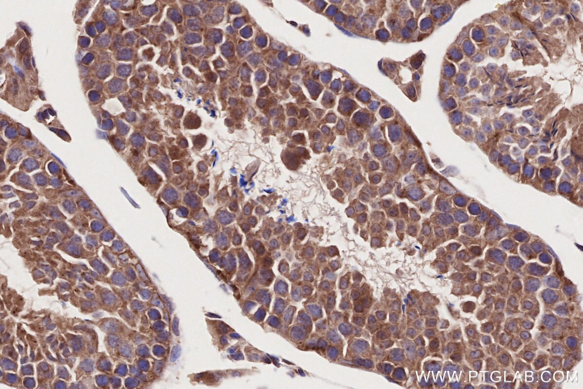 Immunohistochemical analysis of paraffin-embedded mouse testis tissue slide using KHC2715 (BICD2 IHC Kit).