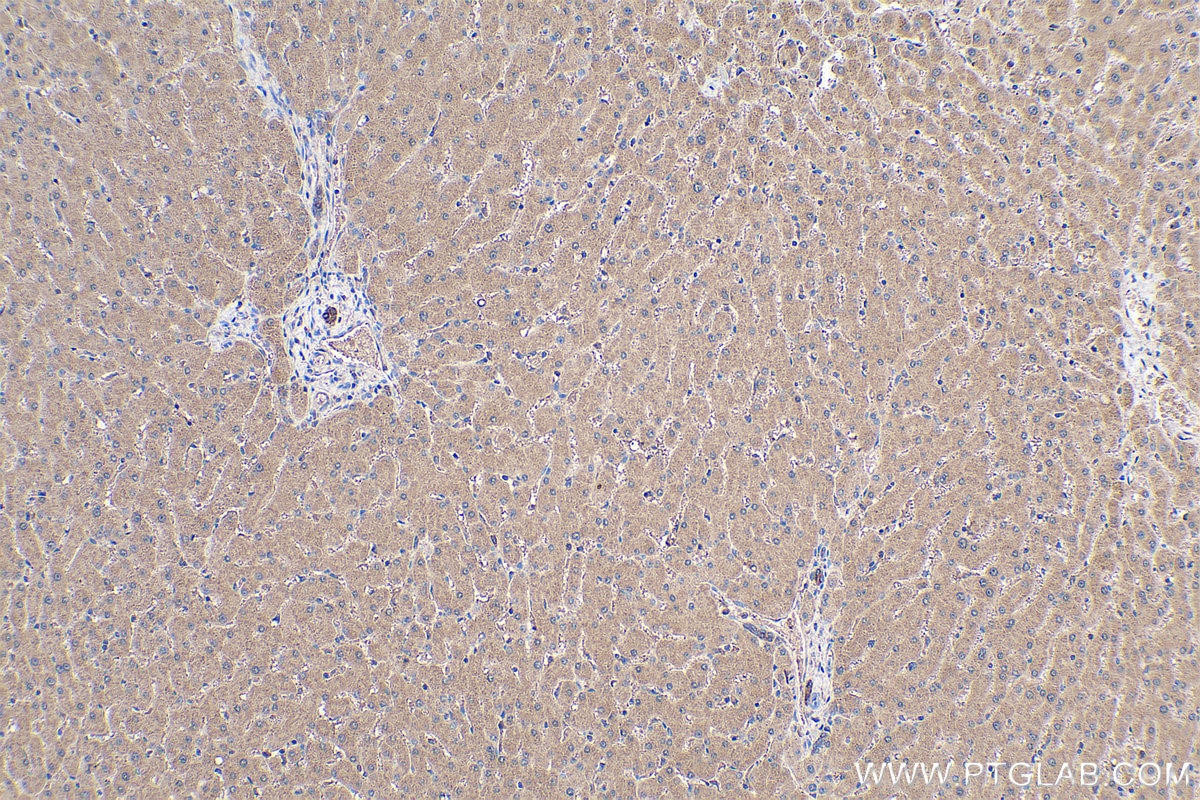 Immunohistochemical analysis of paraffin-embedded human liver tissue slide using KHC0403 (BID IHC Kit).