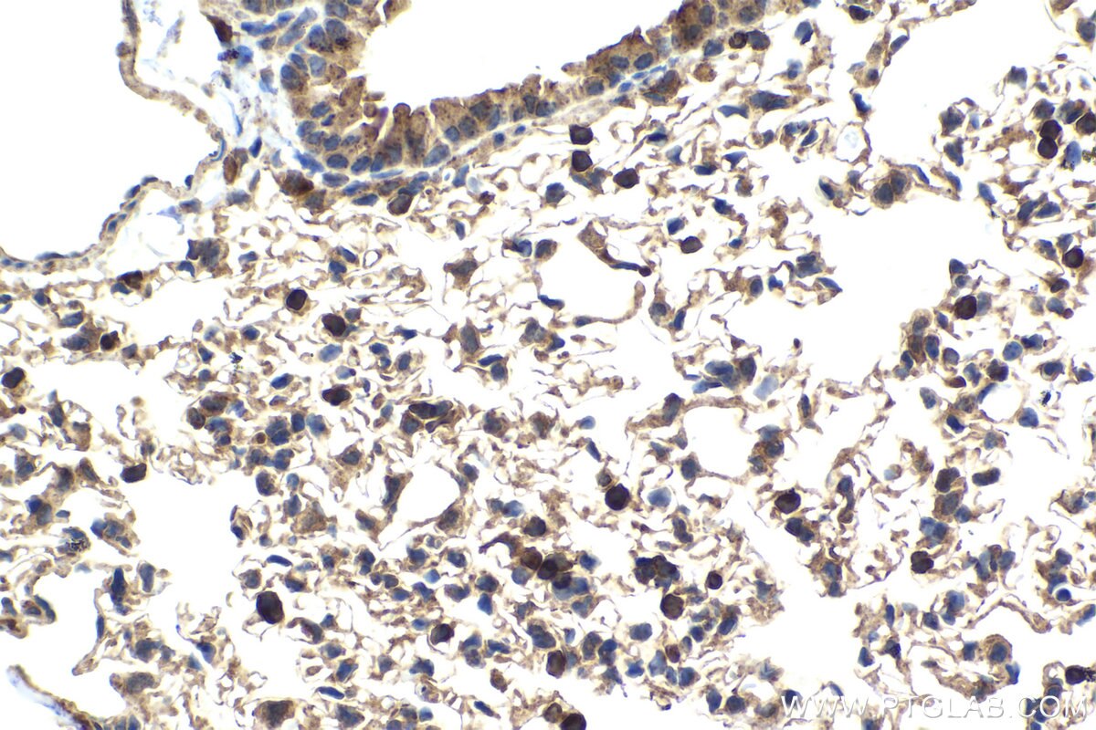 Immunohistochemical analysis of paraffin-embedded mouse lung tissue slide using KHC2048 (BIN1 IHC Kit).