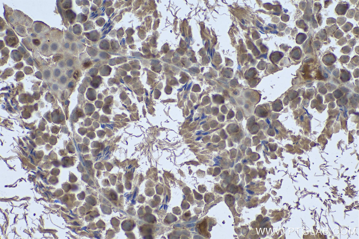 Immunohistochemical analysis of paraffin-embedded mouse testis tissue slide using KHC0620 (cIAP1 IHC Kit).