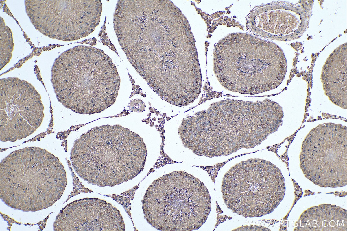 Immunohistochemical analysis of paraffin-embedded rat testis tissue slide using KHC0620 (cIAP1 IHC Kit).