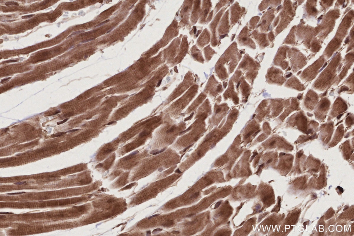Immunohistochemical analysis of paraffin-embedded rat heart tissue slide using KHC2781 (BIRC7 IHC Kit).