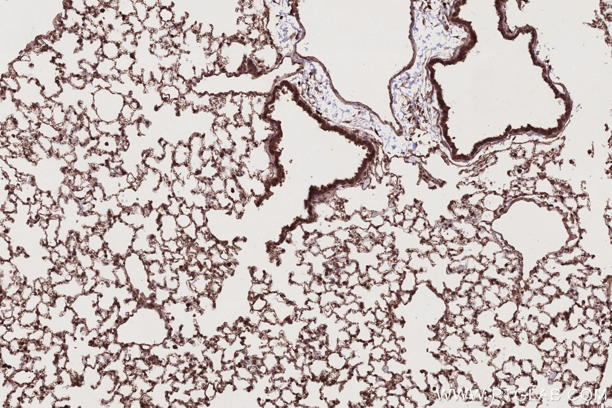 Immunohistochemical analysis of paraffin-embedded mouse lung tissue slide using KHC2781 (BIRC7 IHC Kit).